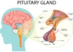 Pituitary Adenoma Causes, Symptoms, Diagnosis, and Treatment