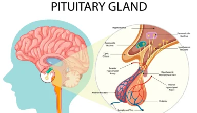 Pituitary Adenoma Causes, Symptoms, Diagnosis, and Treatment