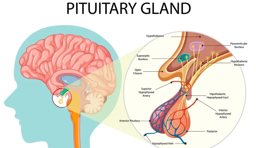 Pituitary Adenoma Causes, Symptoms, Diagnosis, and Treatment